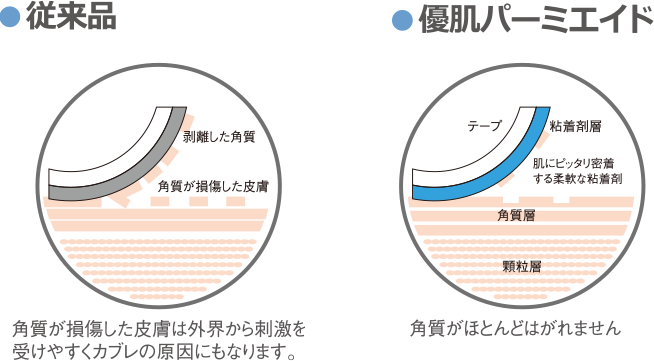 角質保護システム